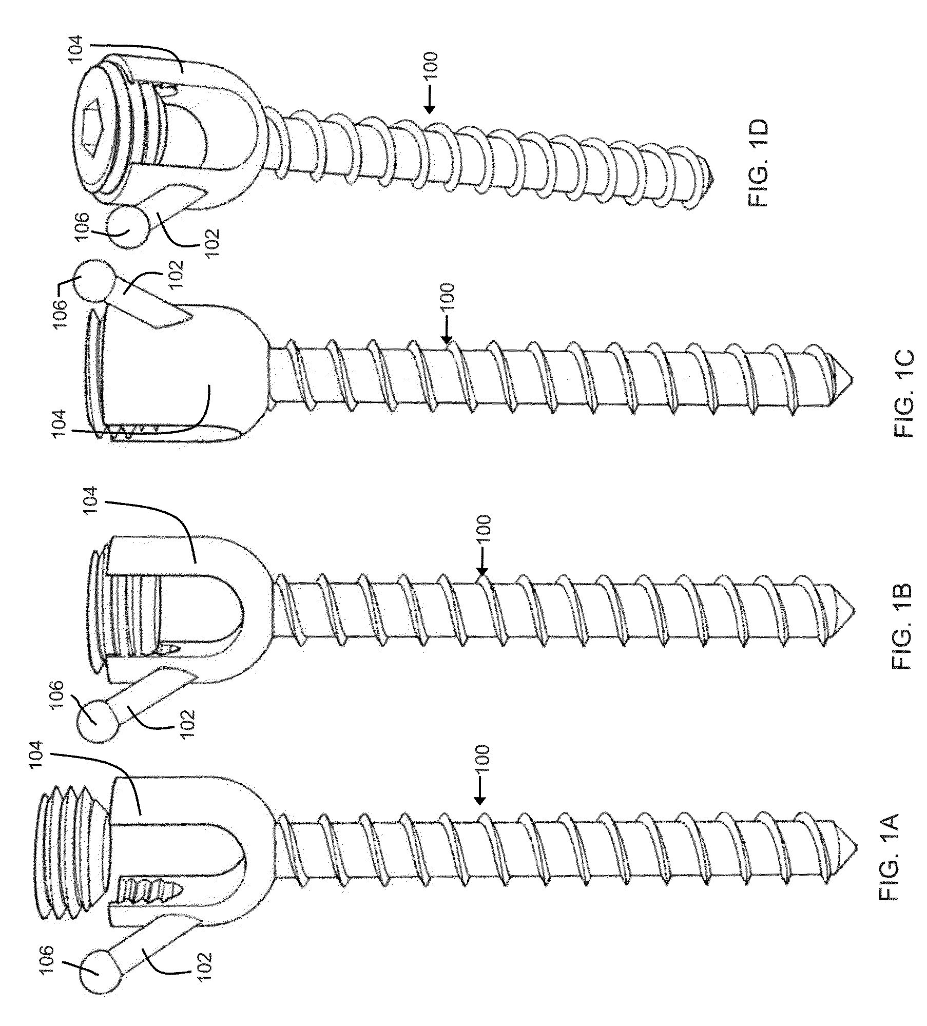 Method and system for the treatment of spinal deformities
