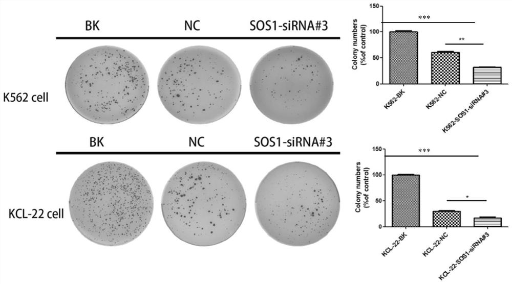 A siRNA targeting and inhibiting the expression of sos1 gene and its application