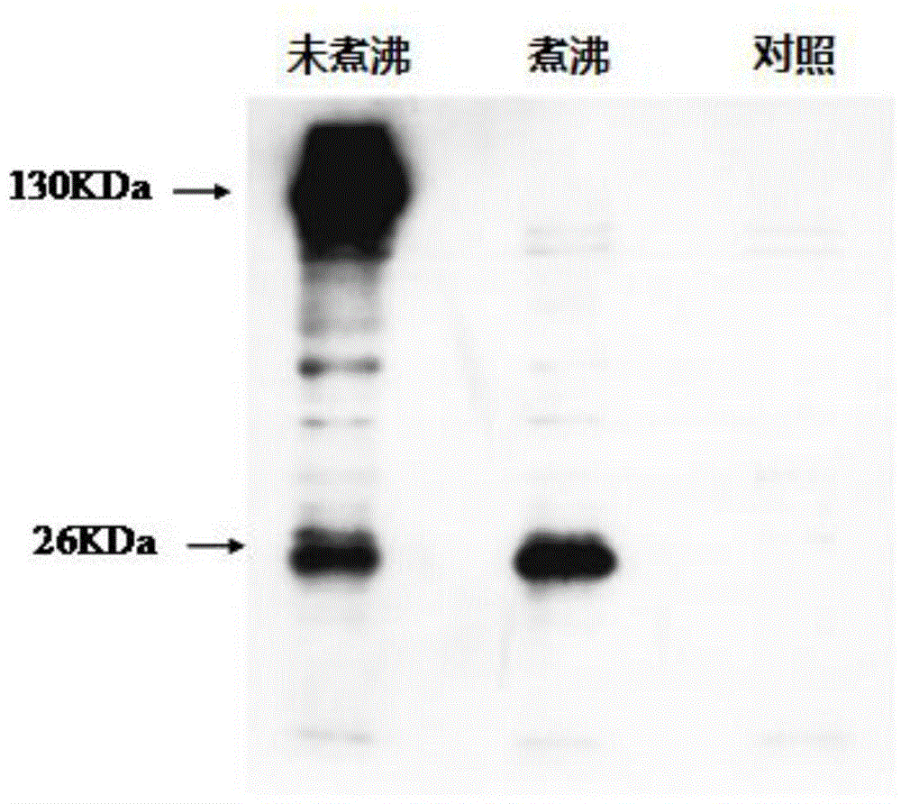 Fusion protein of CTB (Cellulose Tribenzoate), human insulin and glutamic acid decarboxylase 3p531 fragments and application thereof