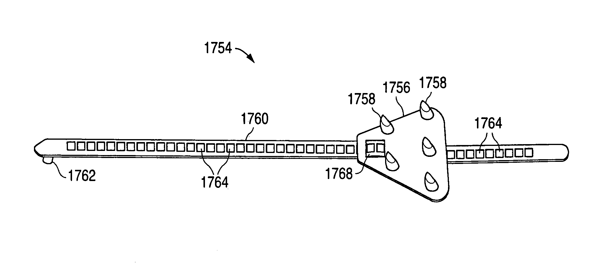 Remotely anchored tissue fixation device