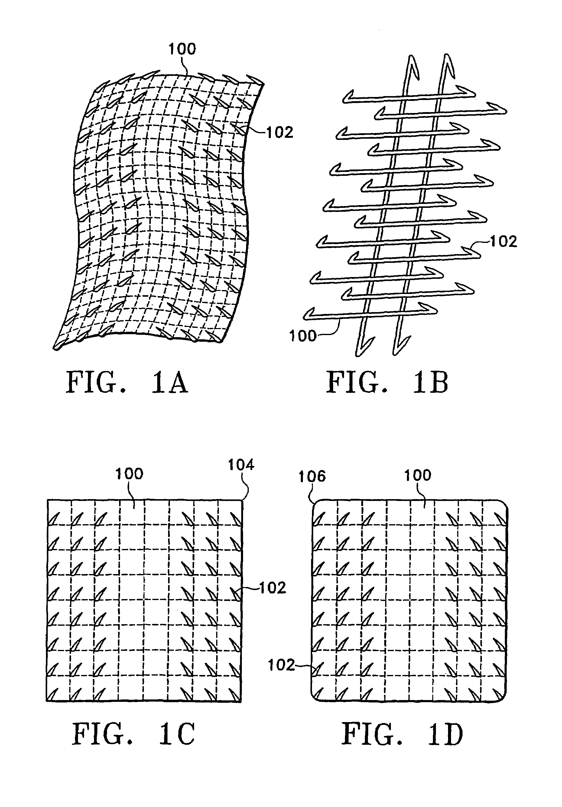 Remotely anchored tissue fixation device