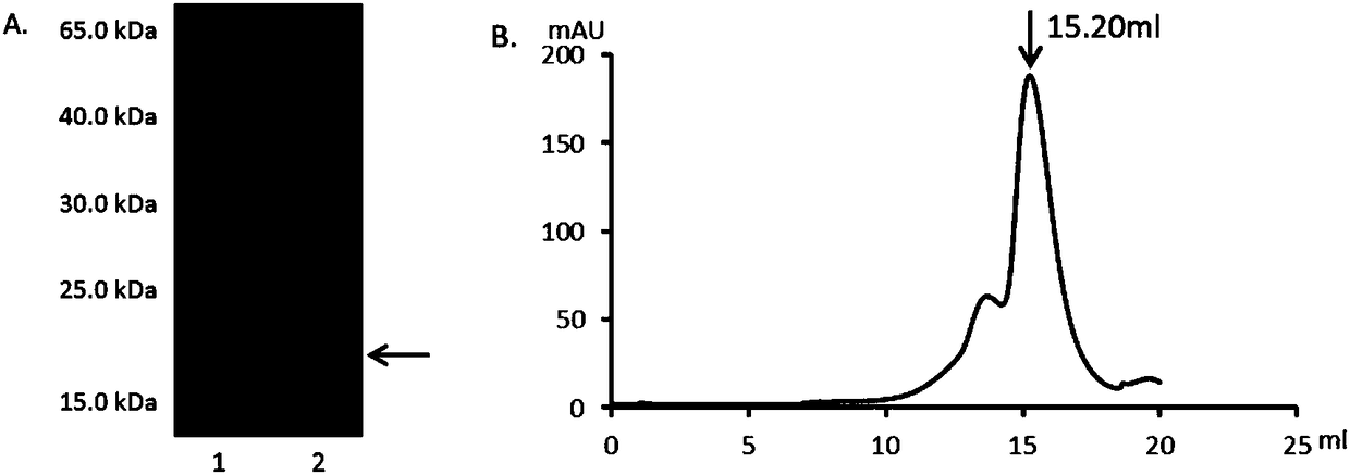 S77 mutant protein of osteoprotegerin, as well as relevant product and application thereof