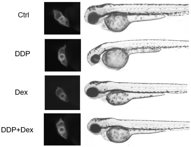 Application of dexrazoxane in preparation of medicine for preventing or treating adverse reaction caused by platinum chemotherapy medicine in chemotherapy