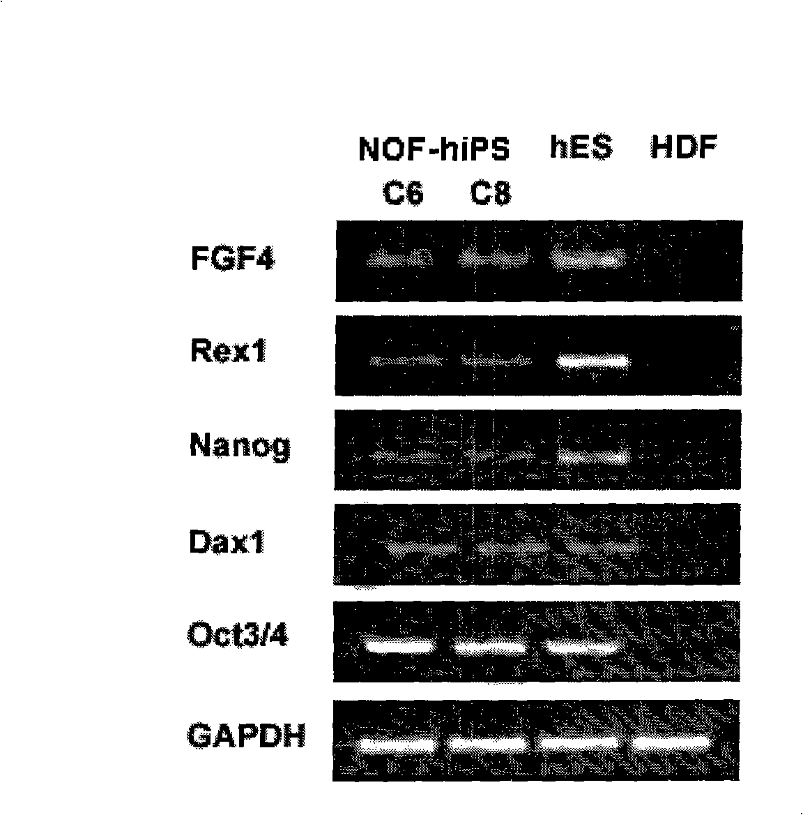 Method for in vitro abduction and cultivation of multi-potentiality stem cell