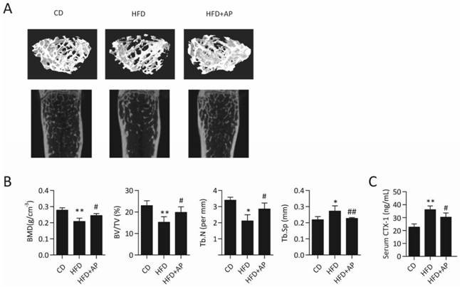 Application of andrographolide in inhibition of osteoclast formation and activation