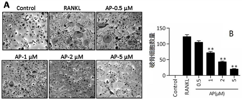 Application of andrographolide in inhibition of osteoclast formation and activation