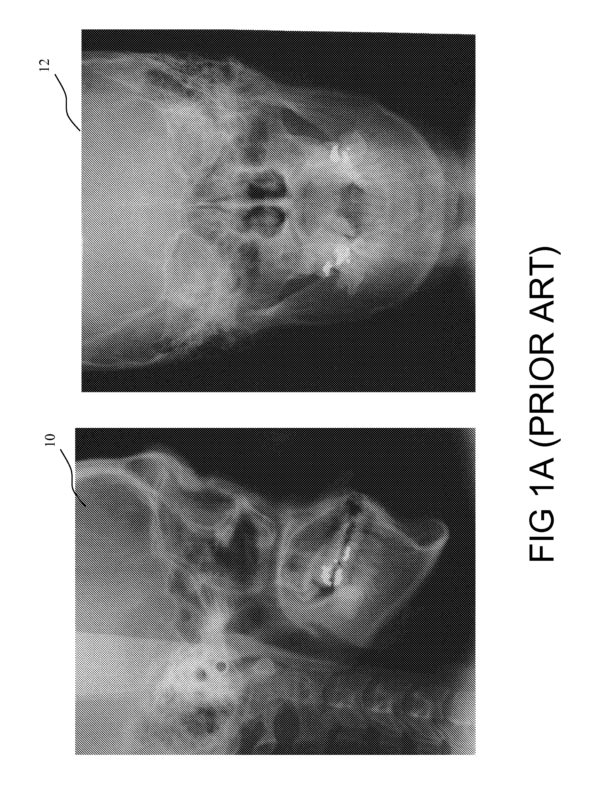 Cephalogram Image Analysis Method