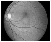 Eye fundus image-based cardiovascular and cerebrovascular disease occurrence type and risk prediction method and system, computer equipment and storage medium