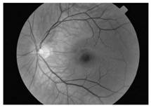 Eye fundus image-based cardiovascular and cerebrovascular disease occurrence type and risk prediction method and system, computer equipment and storage medium