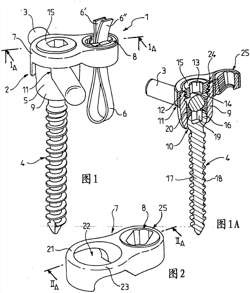 Device and system for fixing a spinal vertebra to a rod