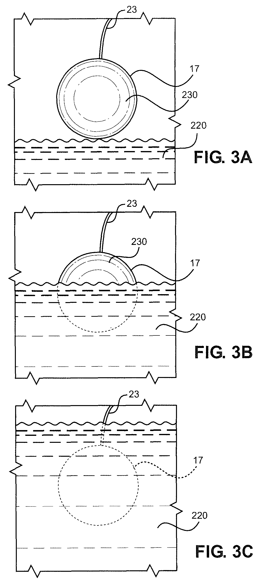 Underwater measurement of bioelectric signals