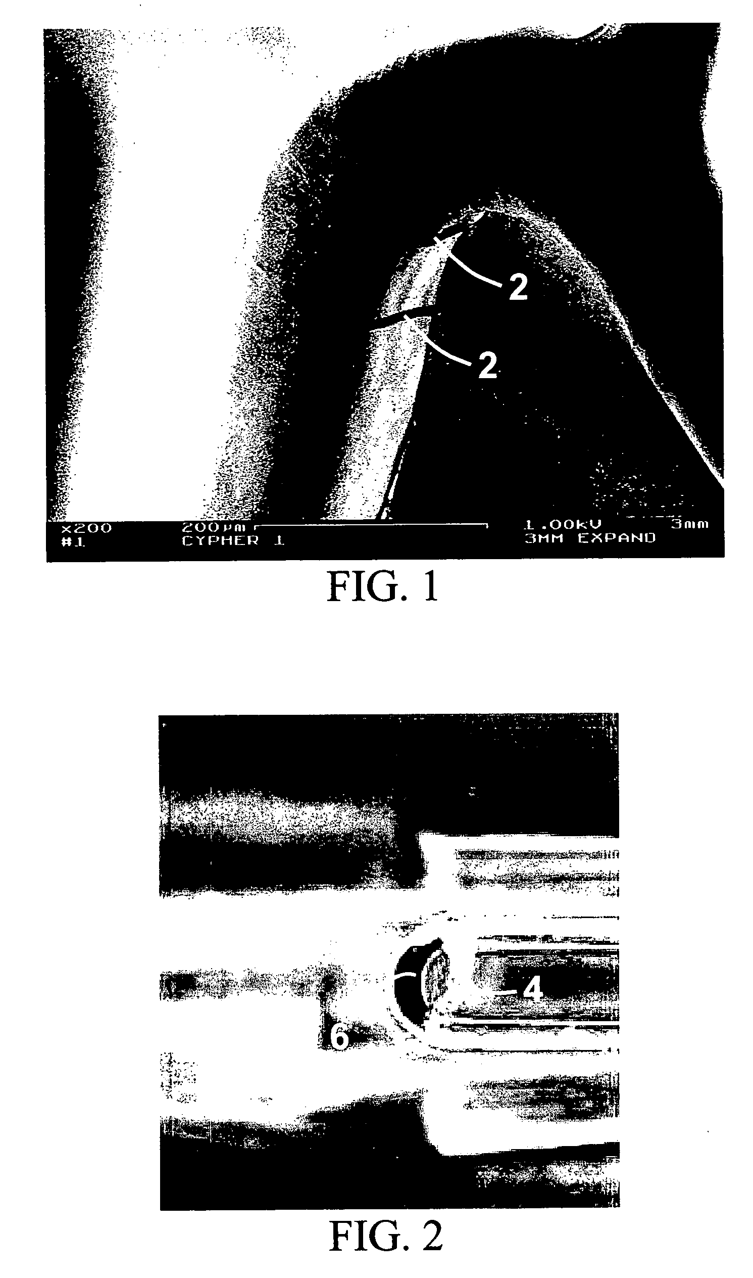 Method for loading nanoporous layers with therapeutic agent