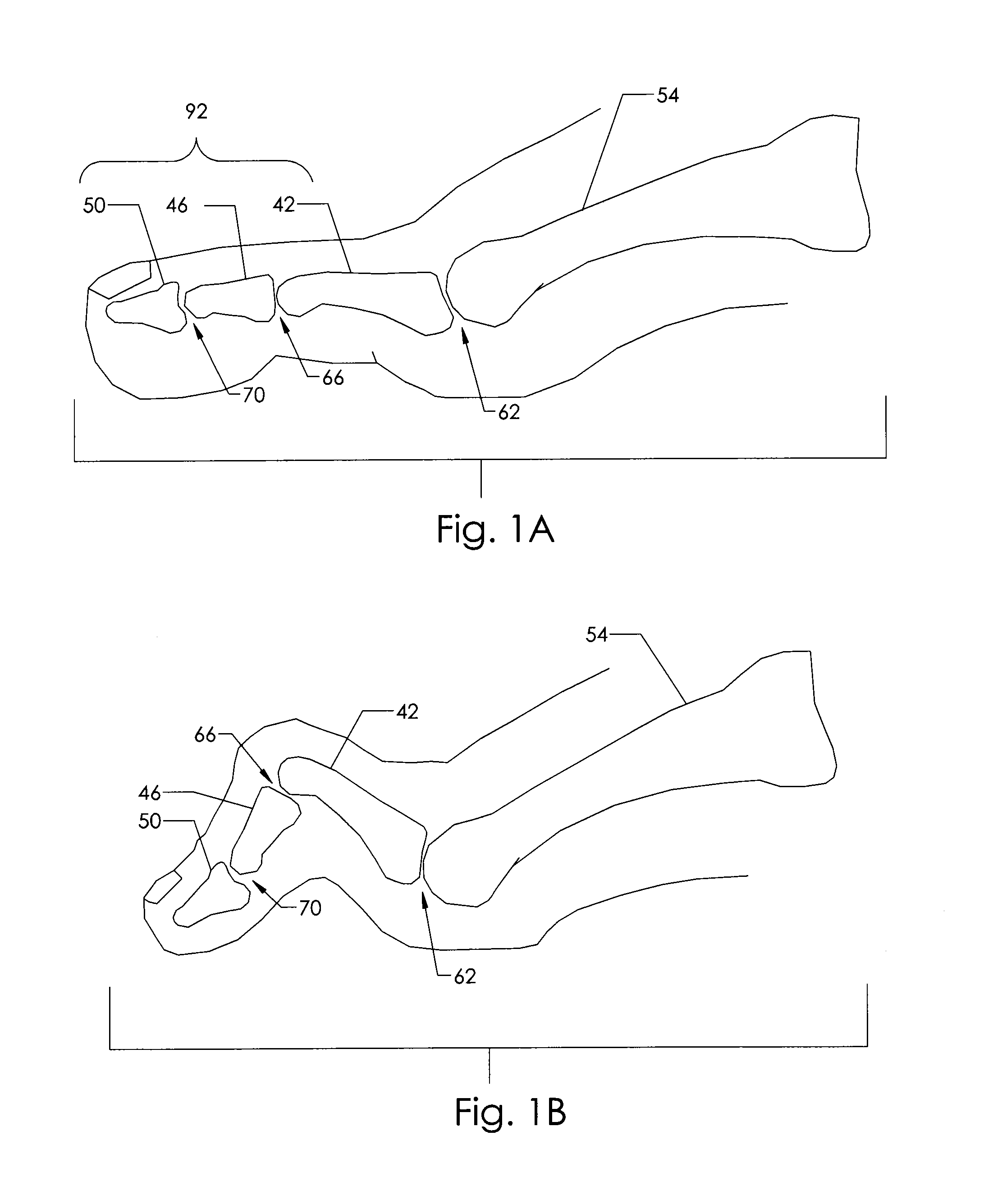 Fasteners with shape changing bellows and methods using same