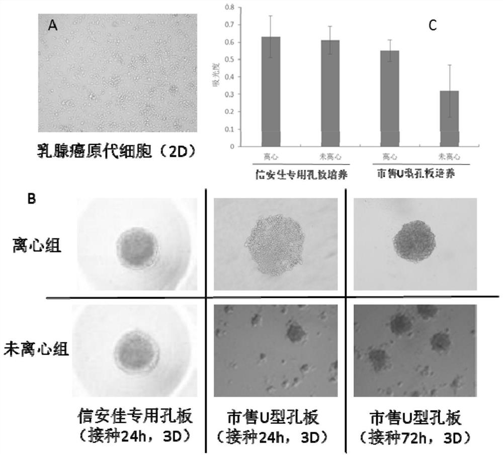 A special culture medium and culture method for scaffold-free organoids of breast cancer