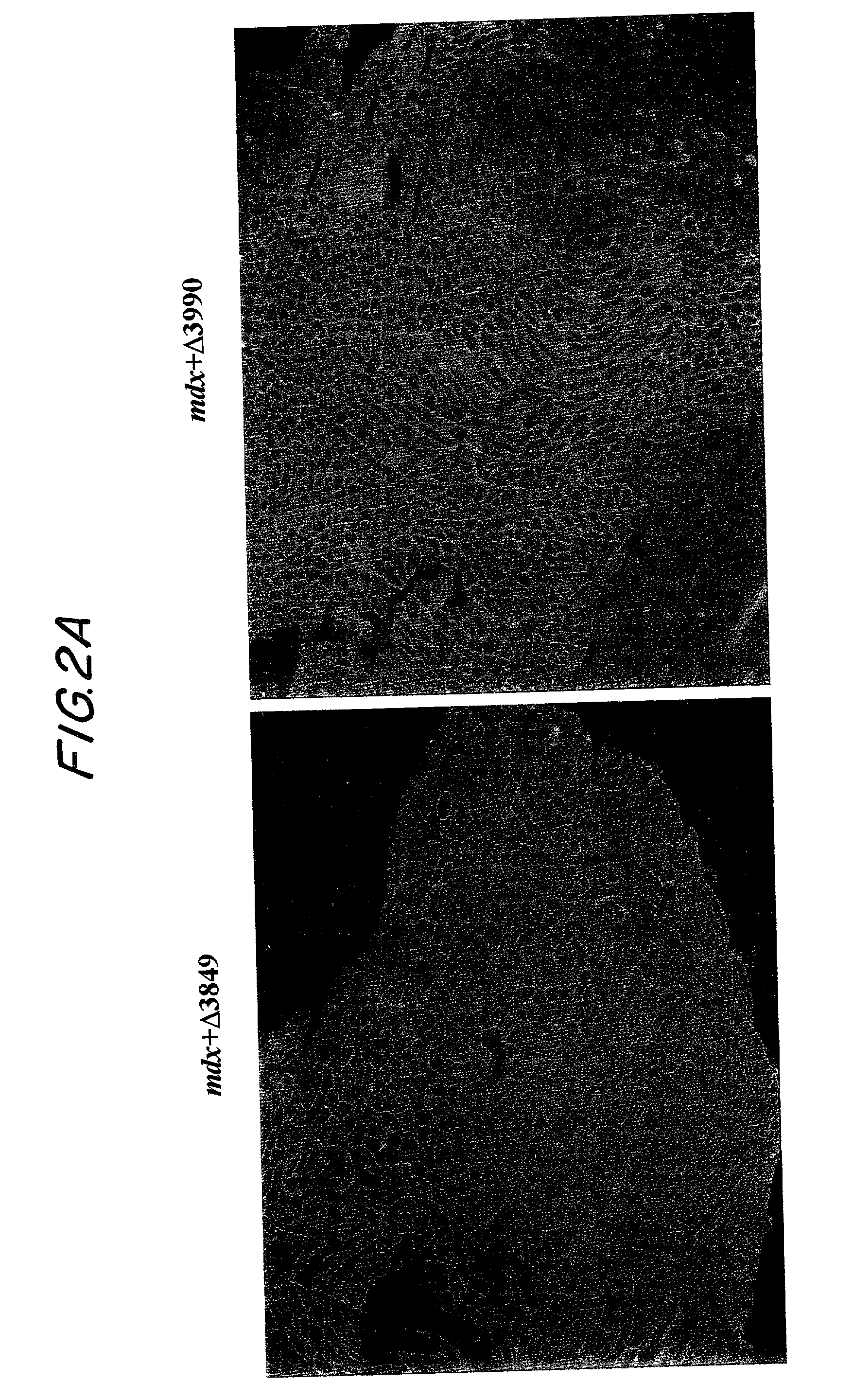 DNA sequences encoding dystrophin minigenes and methods of use thereof
