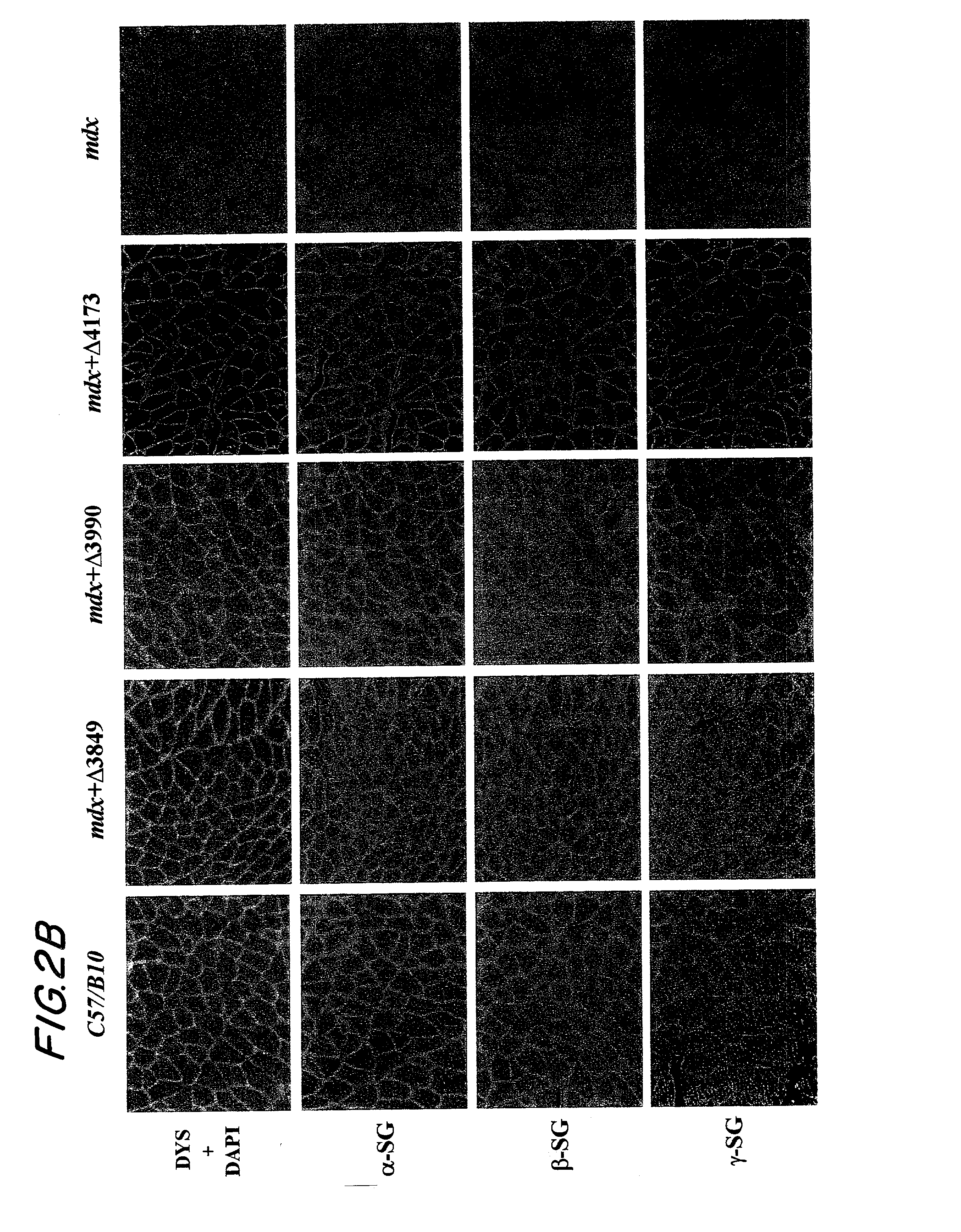 DNA sequences encoding dystrophin minigenes and methods of use thereof
