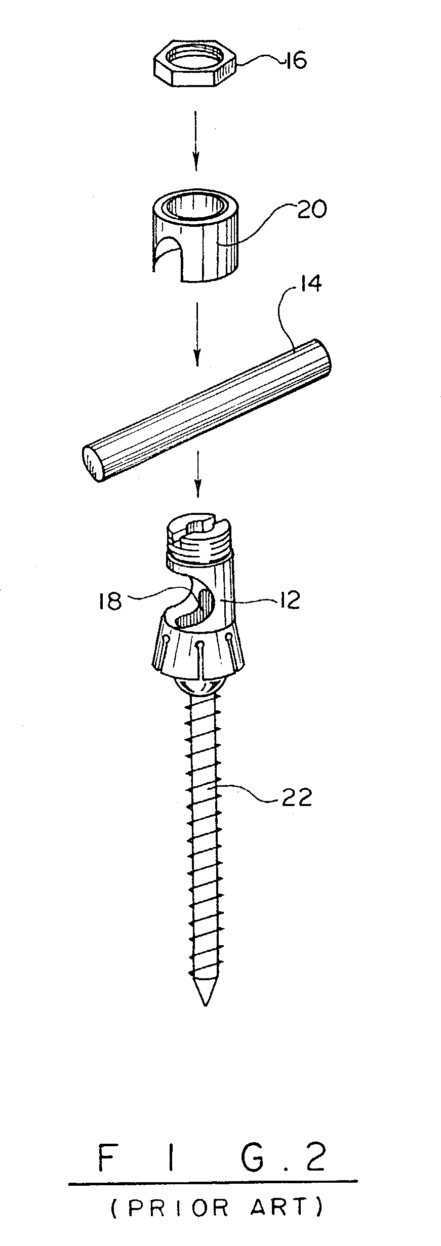 Device and method for percutaneous placement of lumbar pedicle screws and connecting rods