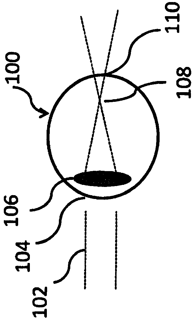 Lenses, devices, methods and systems for refractive error