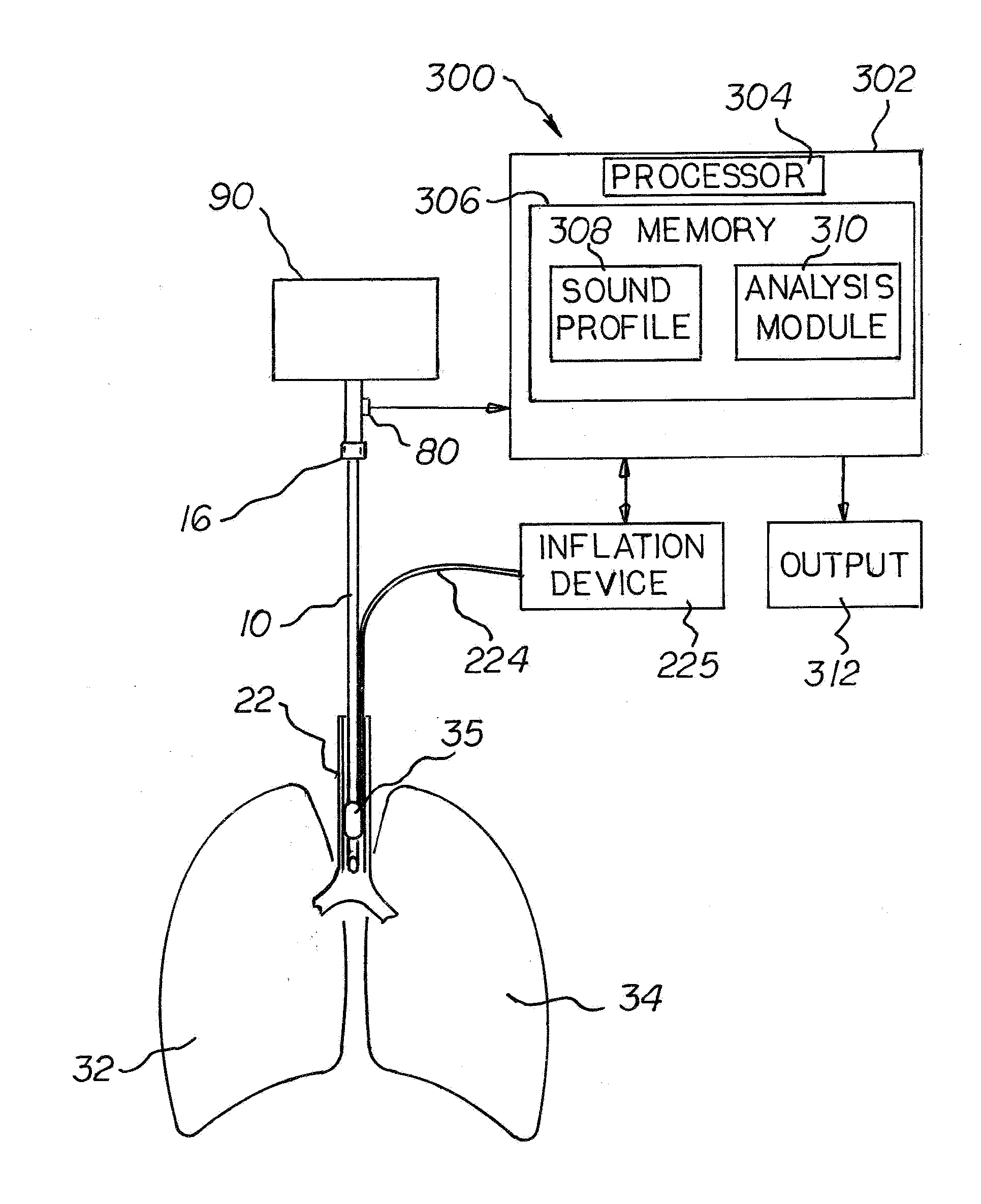 Leak detection system and method for tube or catheter placement