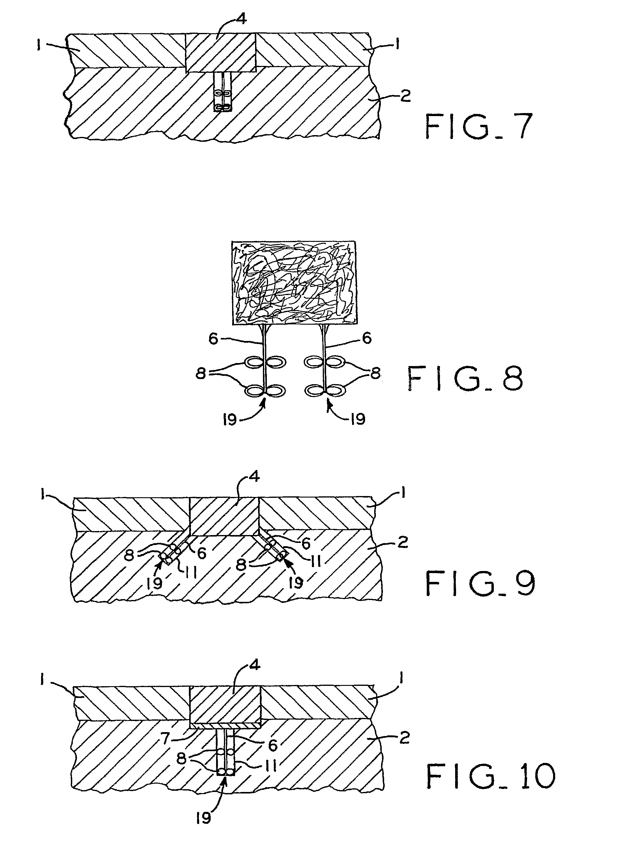Articular cartilage fixation device and method