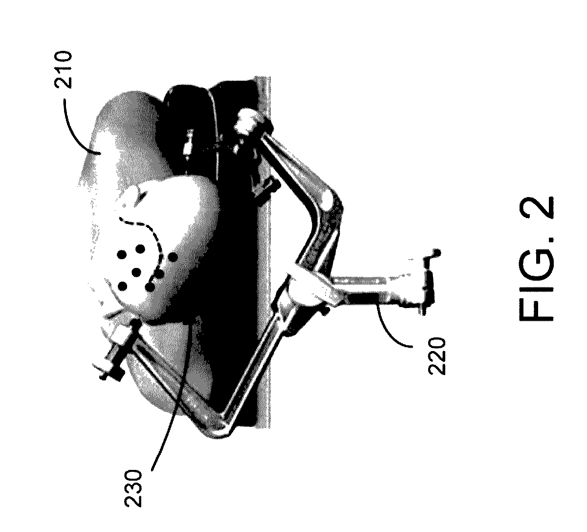 Method and system for trackerless image guided soft tissue surgery and applications of same