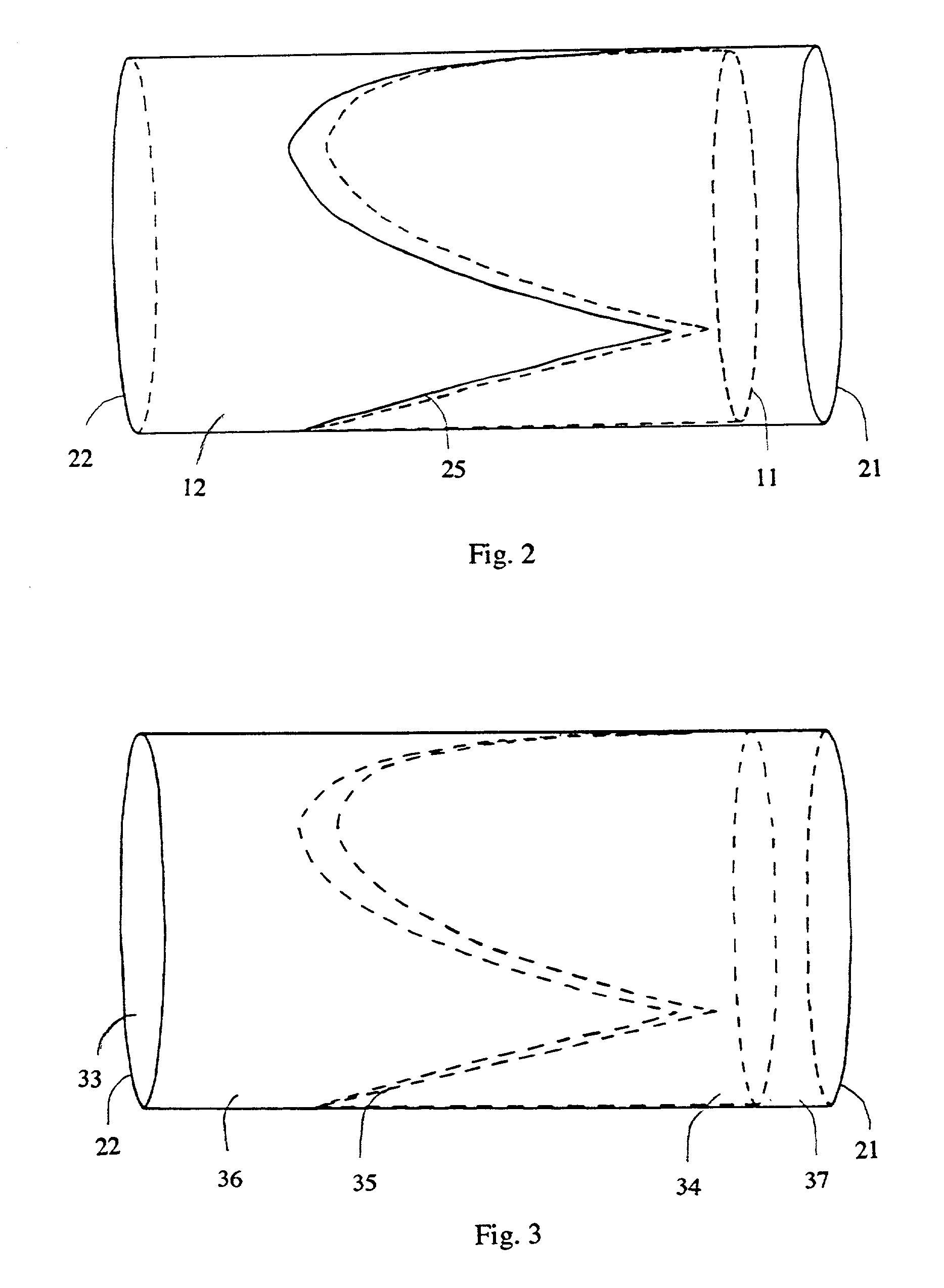 Venous valve and graft combination