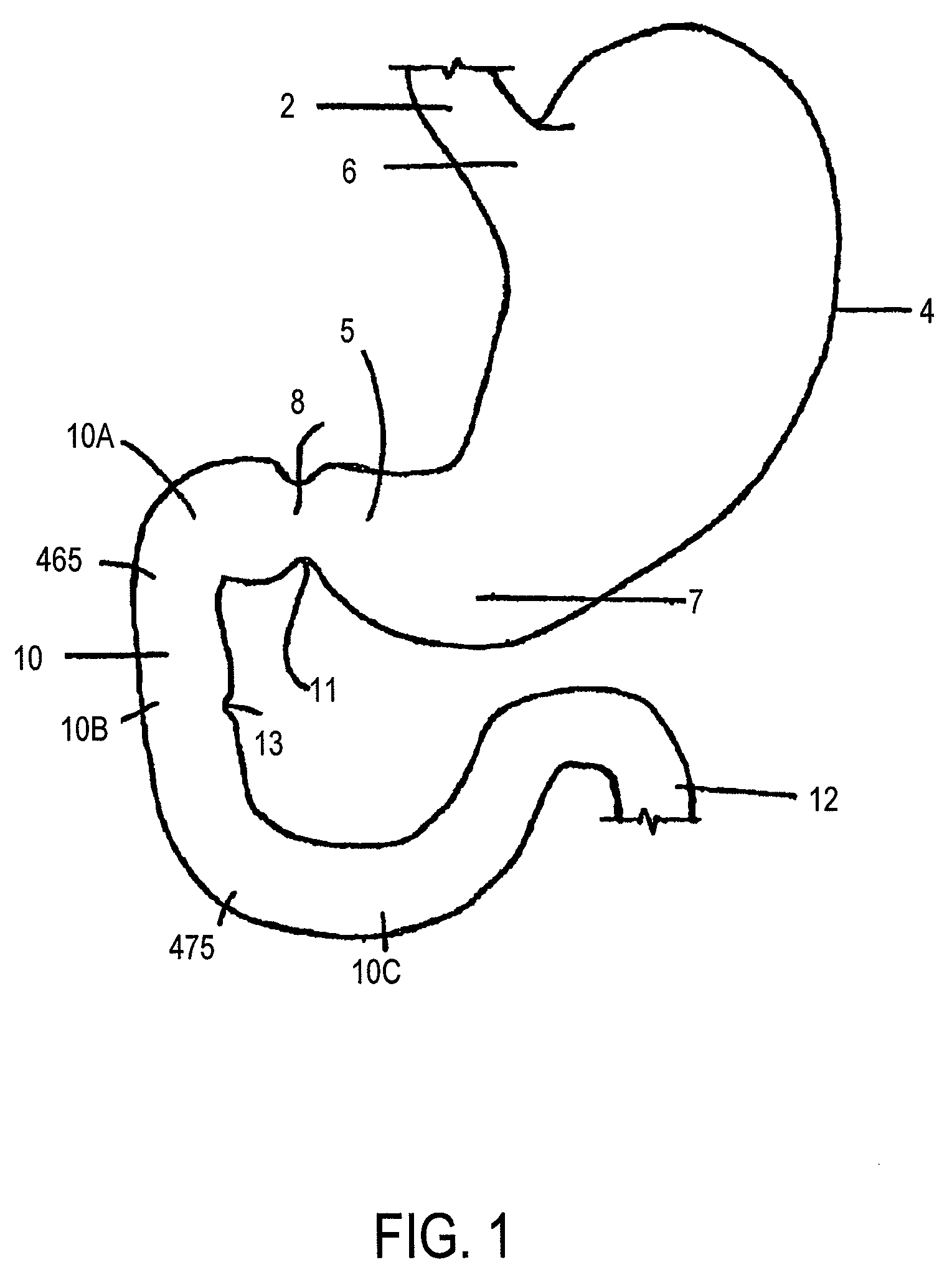 Conformationally-stabilized intraluminal device for medical applications
