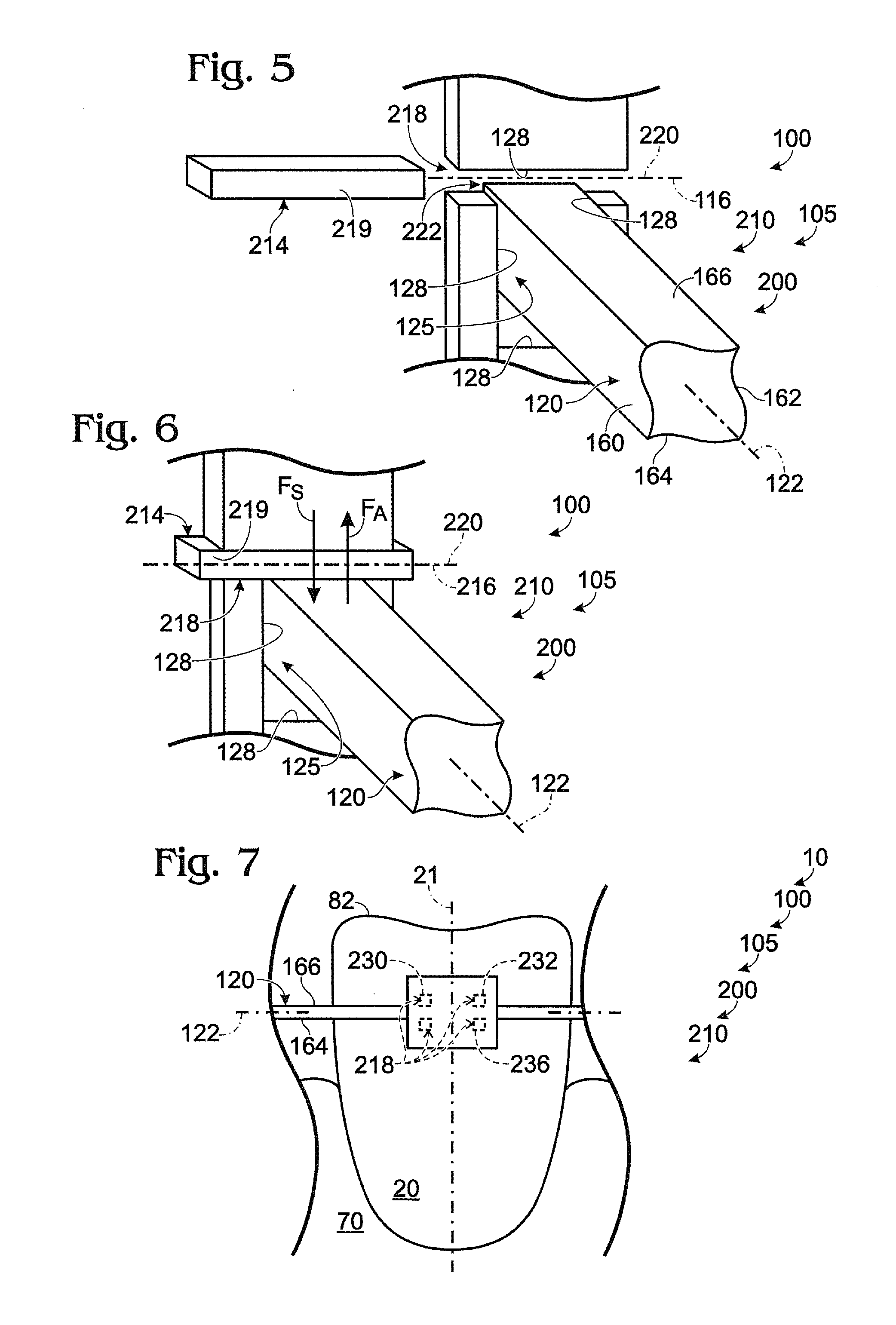 Prescription-altering accessories for orthodontic brackets, and orthodontic bracket assemblies including the same