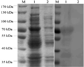 Preparation method and application of anti-hpv16 L1 protein monoclonal antibody