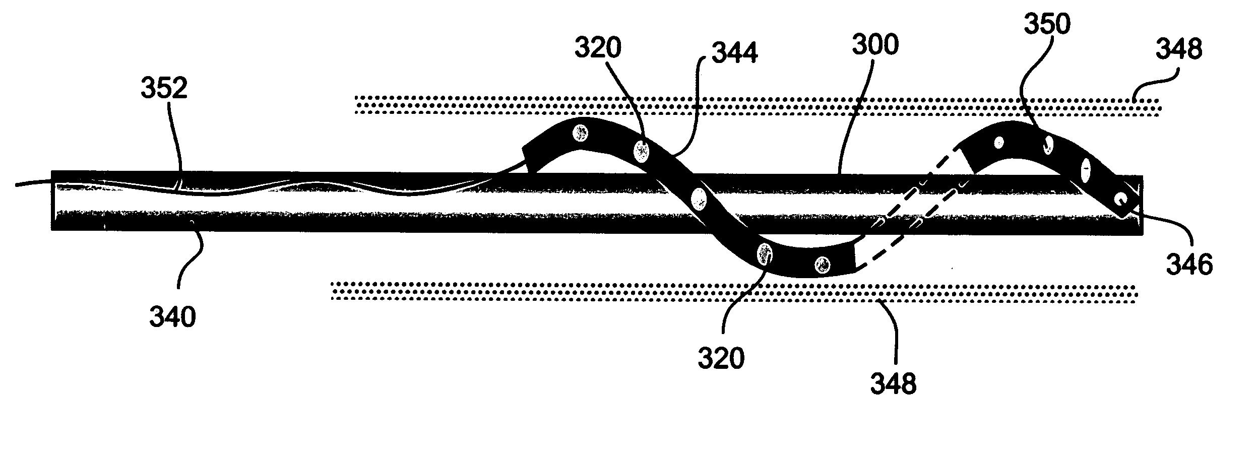 Thermal sensing device for thermal mapping of a body conduit