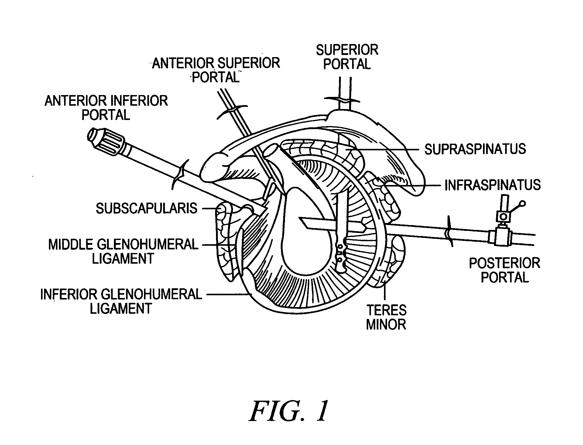 Devices, systems and methods for tissue repair