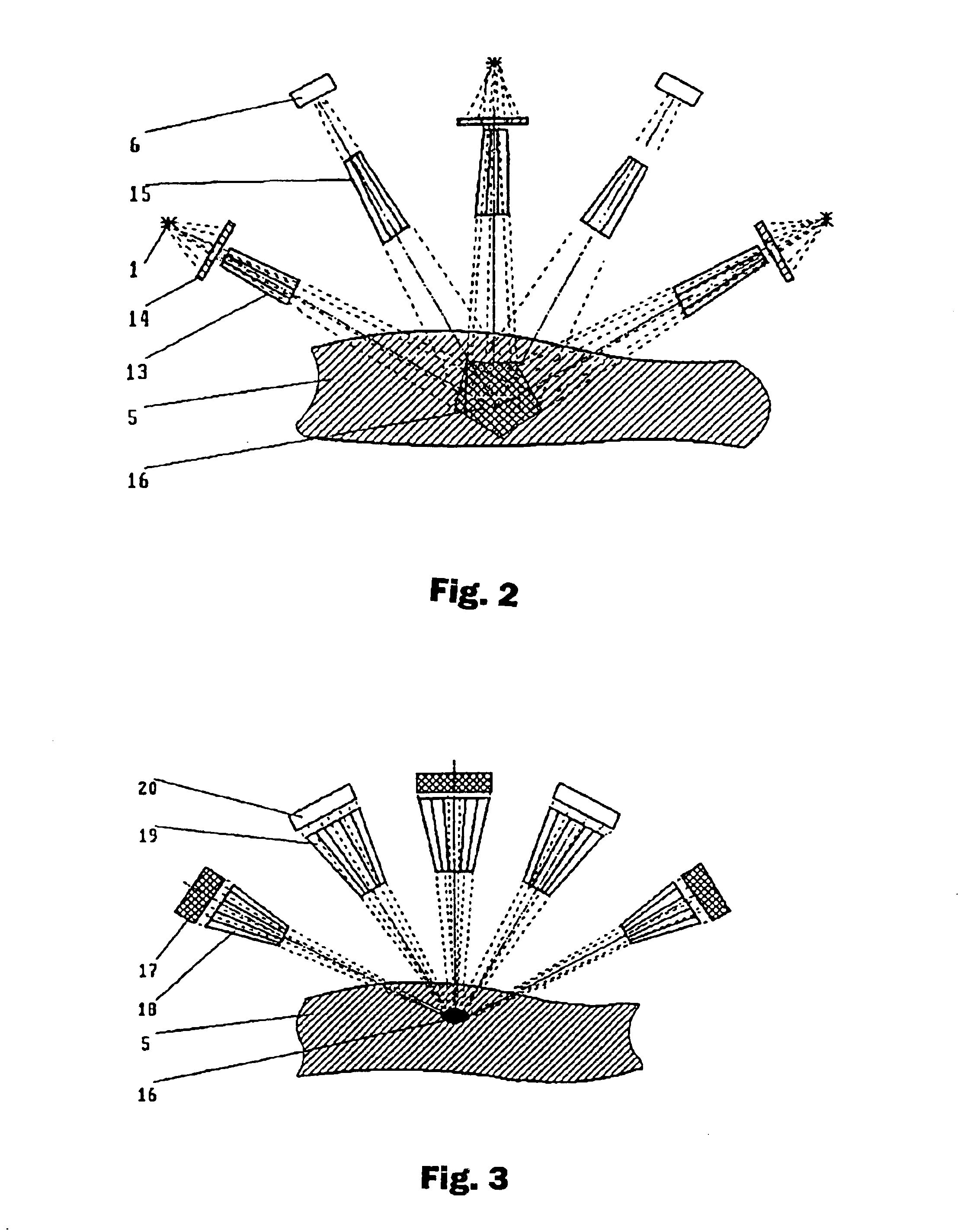 Method for obtaining a picture of the internal structure of an object using x-ray radiation and device for the implementation thereof