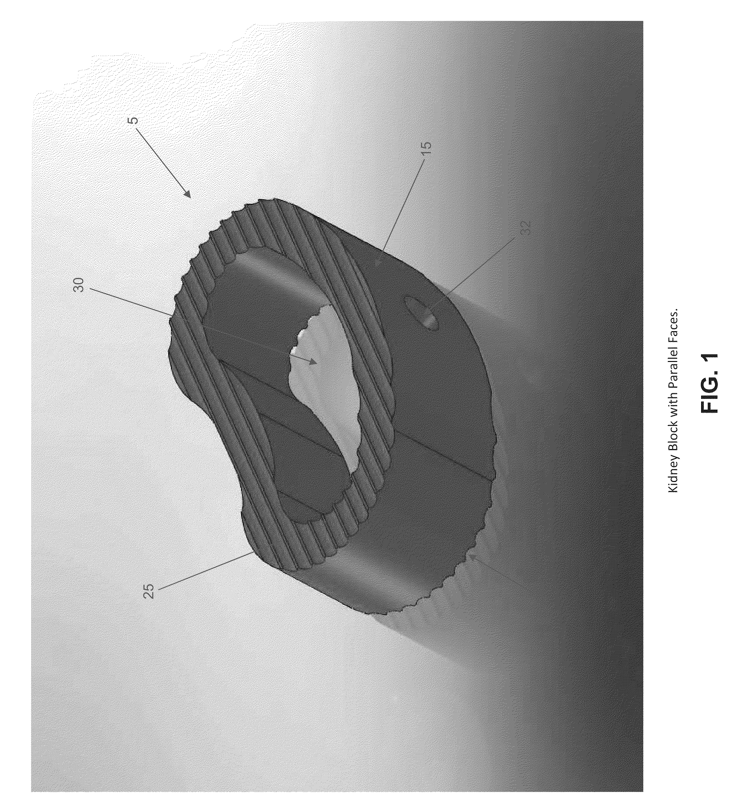 Method and apparatus for fusing the bones of a joint