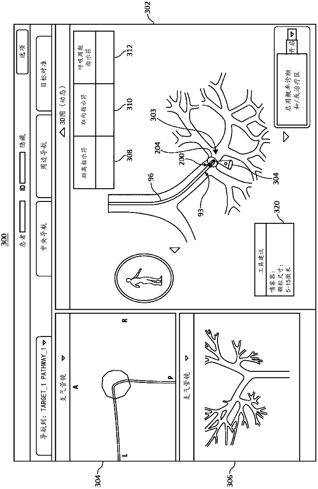 System and method for navigational bronchoscopy and selective drug delivery