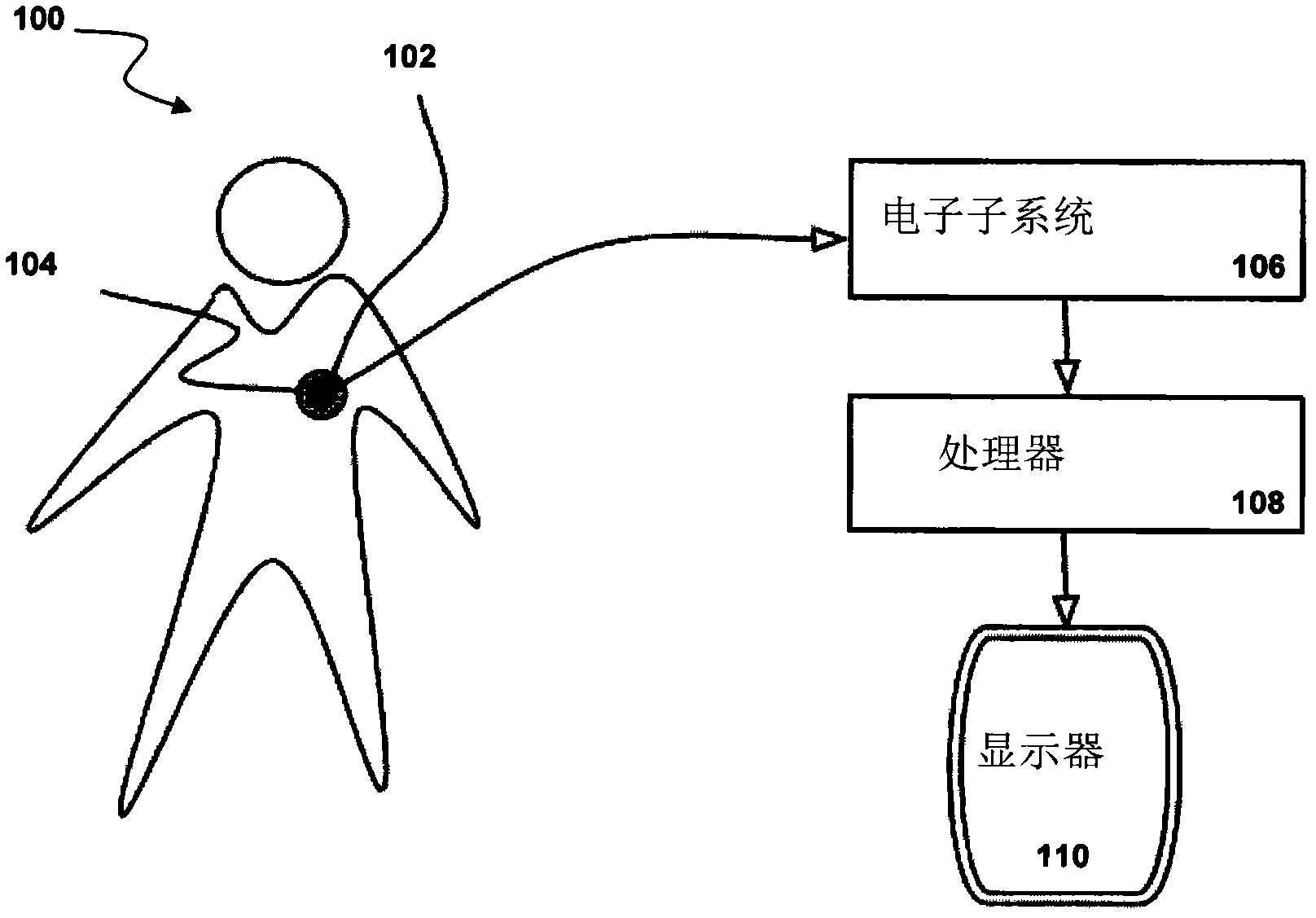 Systems and methods for detecting cardiovascular disease