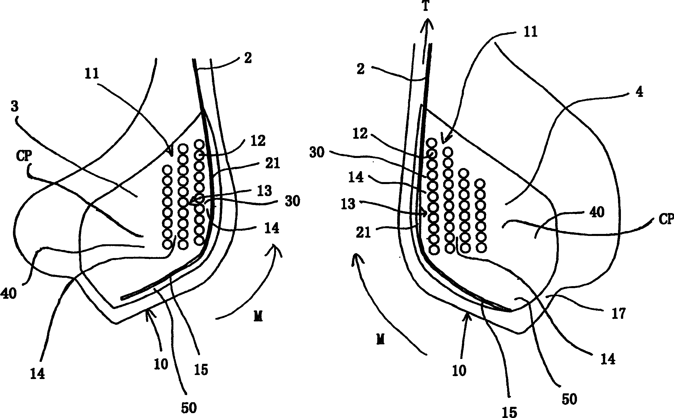 Tyre bead with extended mobility
