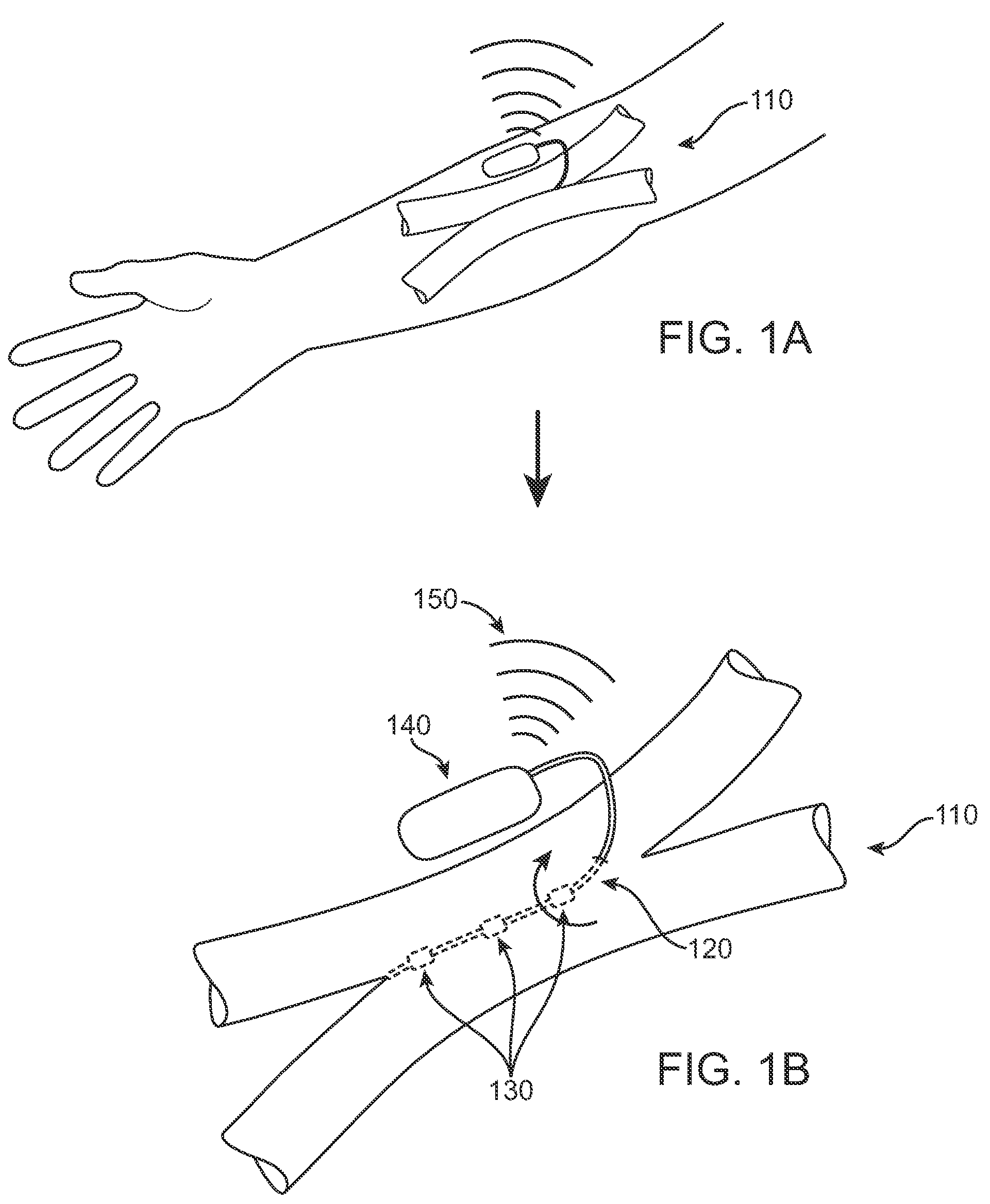 Body-associated fluid transport structure evaluation devices