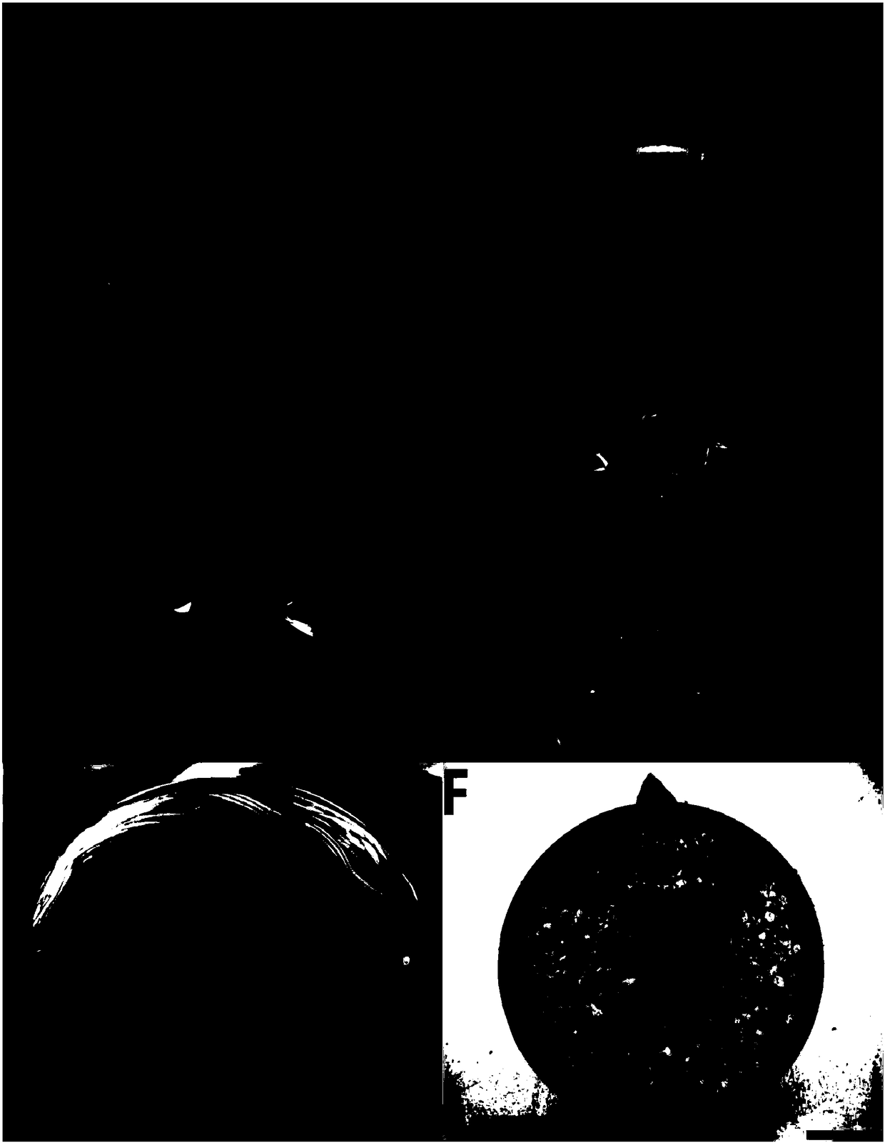 Method and culture medium for efficient in vitro rapid propagation of clematis