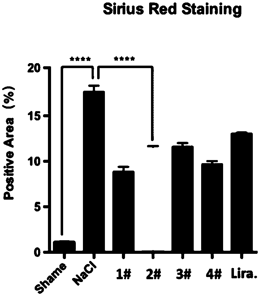 Treatment for biliary cirrhosis through GLP-1R/GCGR double-target-point agonist polypeptide