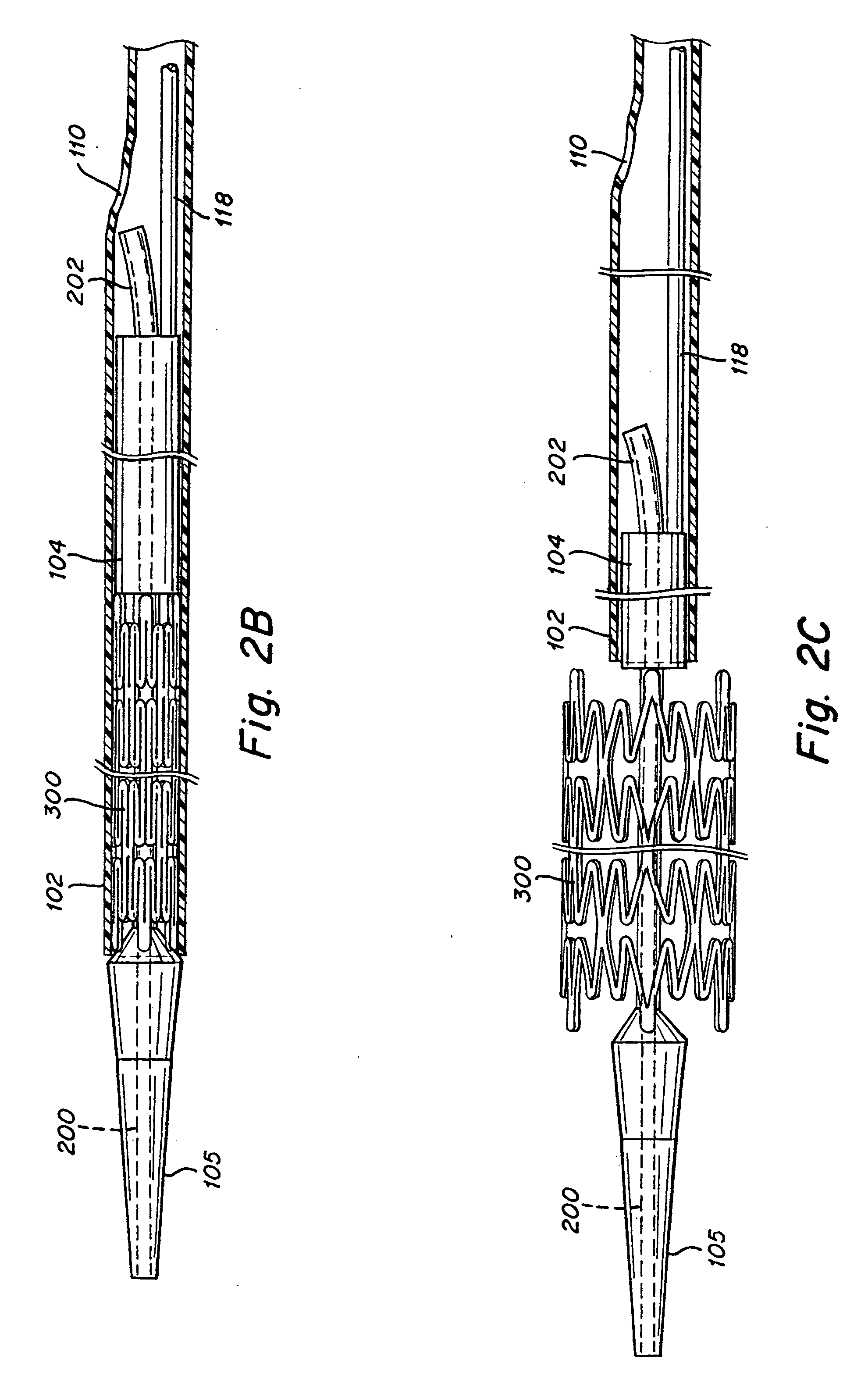 Implant delivery system with interlocked RX port orientation