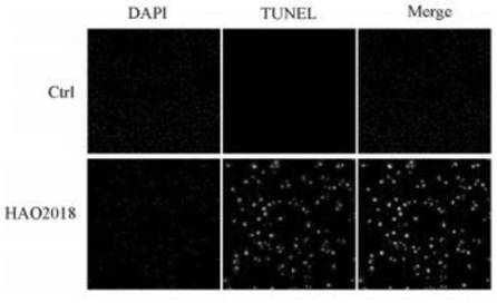 Pediococcus acidilactici with anti-cervical cancer effect and application