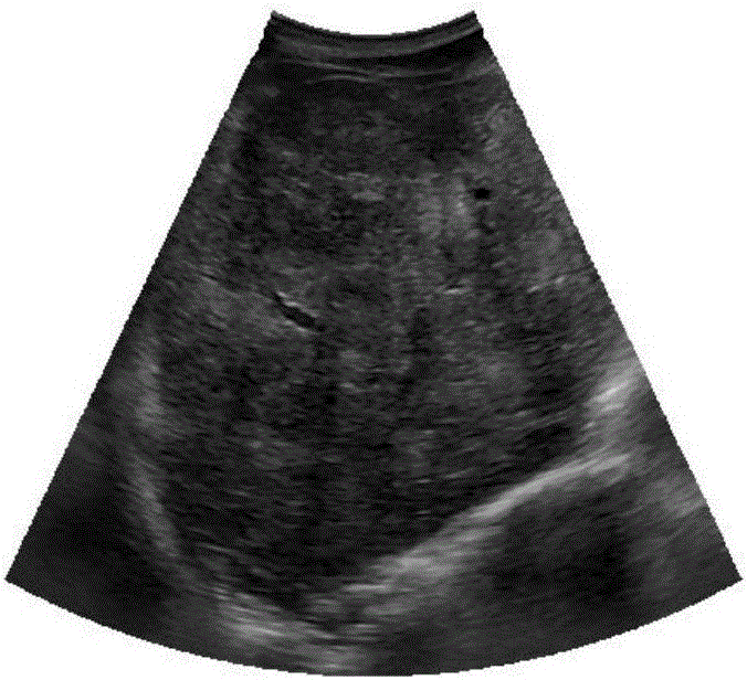 Method for extracting liver region in ultrasound image