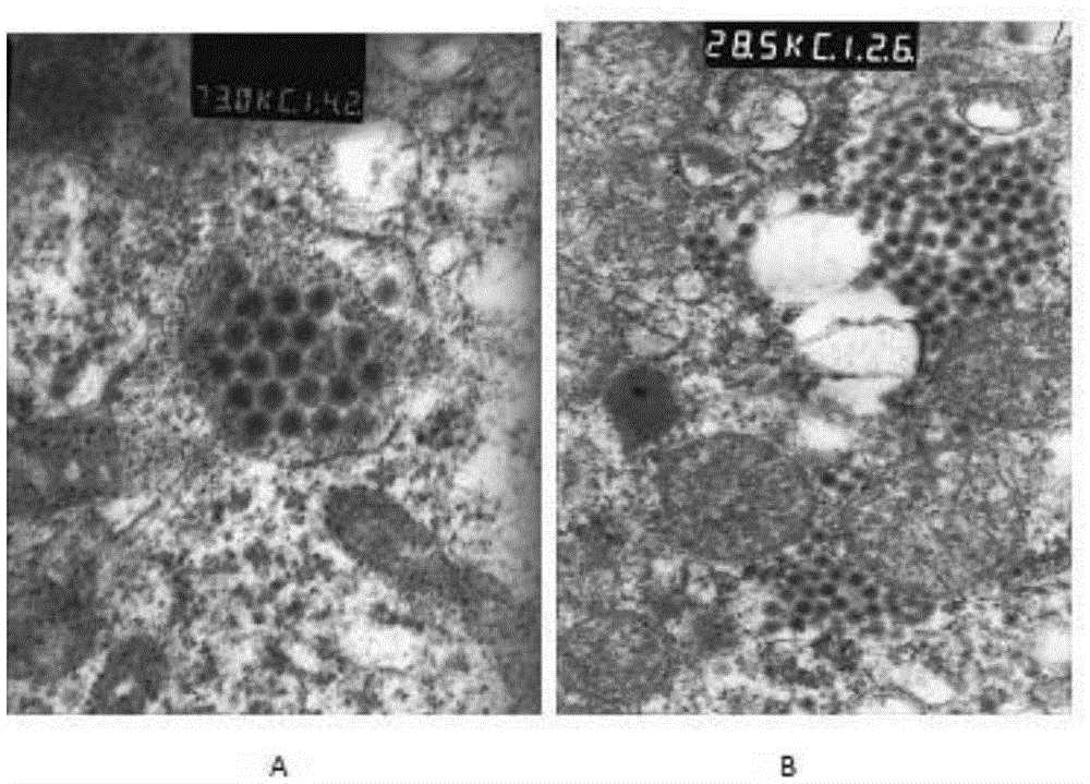 A grass carp swim bladder epithelioid cell line and its application