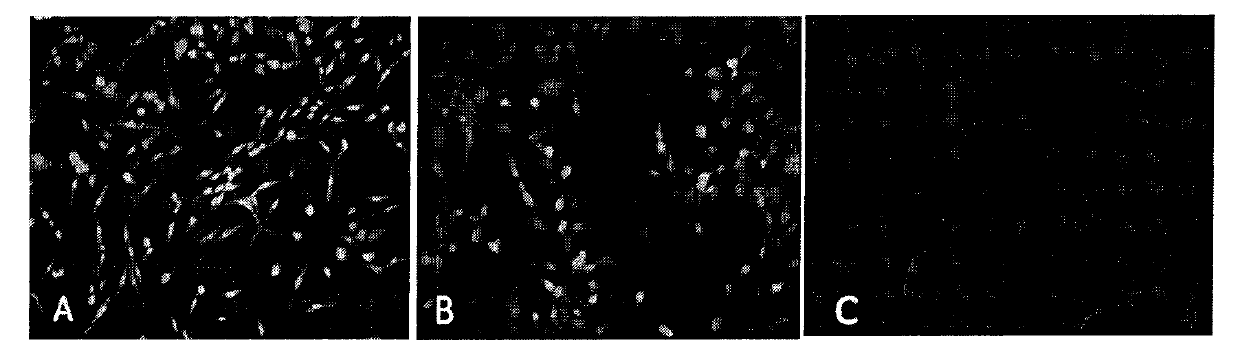 J substock lymphoid leuoosis-resistant polyclonal antibody and preparation method thereof