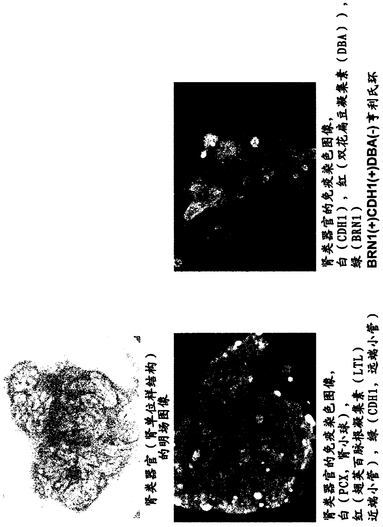 Method for inducing differentiation of intermediate mesodermal cell to renal progenitor cell, and method for inducing differentiation of pluripotent stem cell to renal progenitor cell