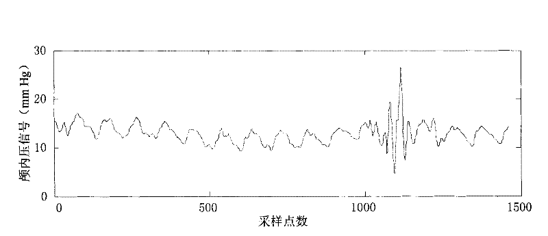 Beat-to-beat division method of intracranial pressure signal based on waveform character matching