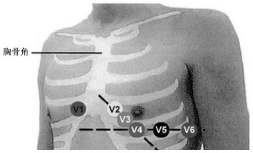 An automated and standardized electrocardiogram acquisition system and method