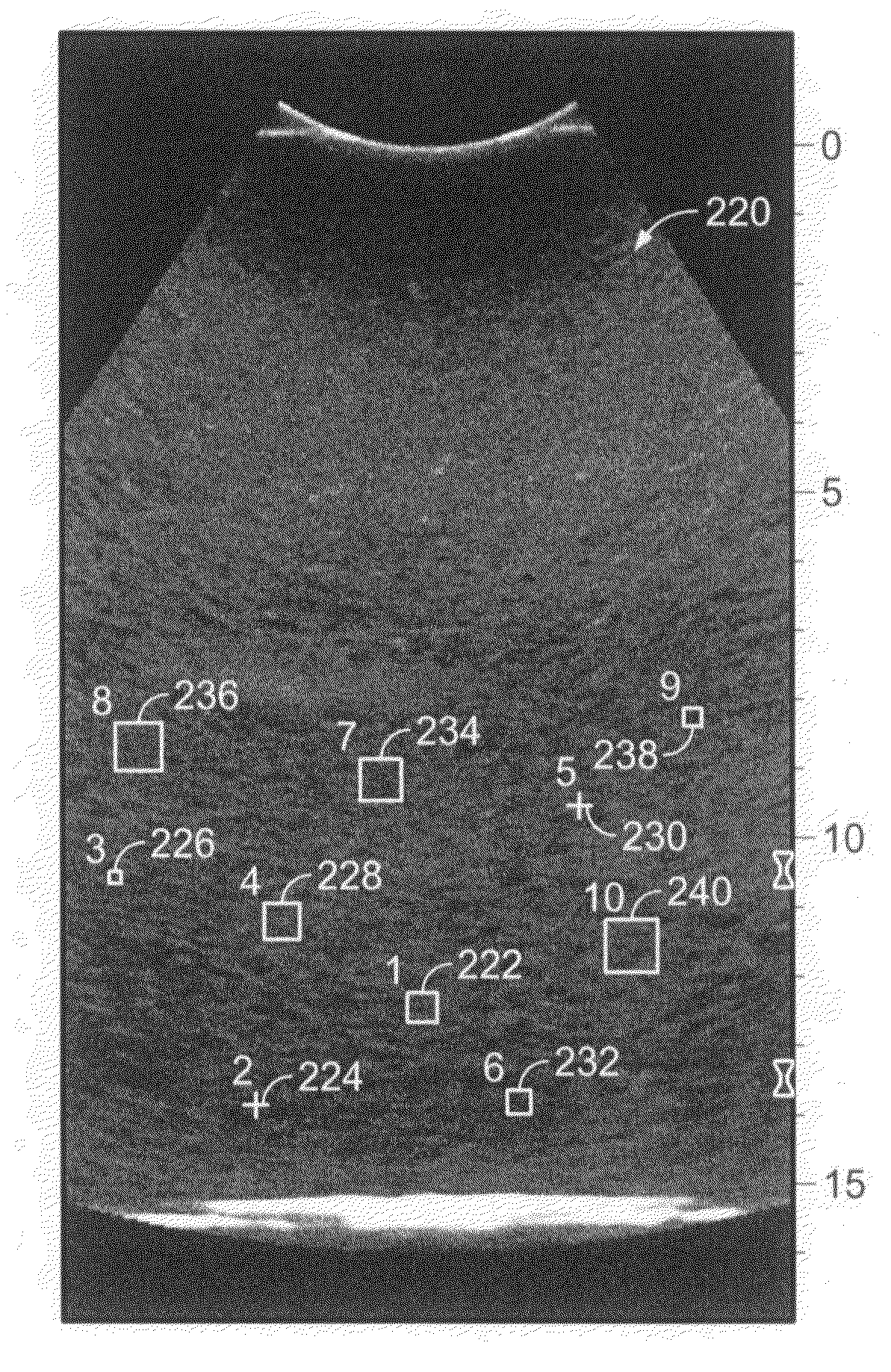 Method and apparatus for tracking points in an ultrasound image
