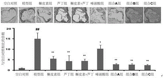 Medicine composition and application of medicine composition to preparing medicines for preventing and treating atherosclerosis and dyslipidemia