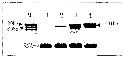 Tea geometrid reverse transcription transposon gene rtp and application thereof